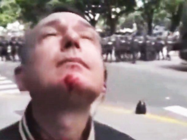 Represión en la 9 de Julio: un periodista de Crónica TV recibió un balazo de goma en la pera