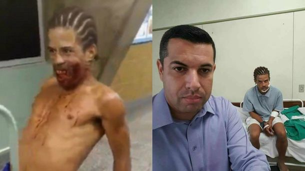 Antes y después del extraño caso en un hospital de Brasil
