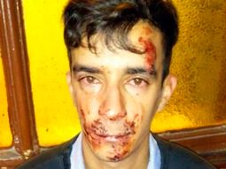 brutal ataque de una patota de adolescentes a un electricista en la plata brutal ataque de una patota de adolescentes a un electricista en la plata