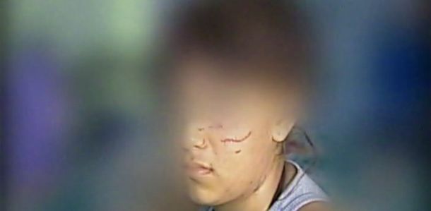 Brutal caso de bullying contra una adolescente de 14 años