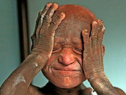 el extrano caso del nene que se esta convirtiendo en piedra el extrano caso del nene que se esta convirtiendo en piedra