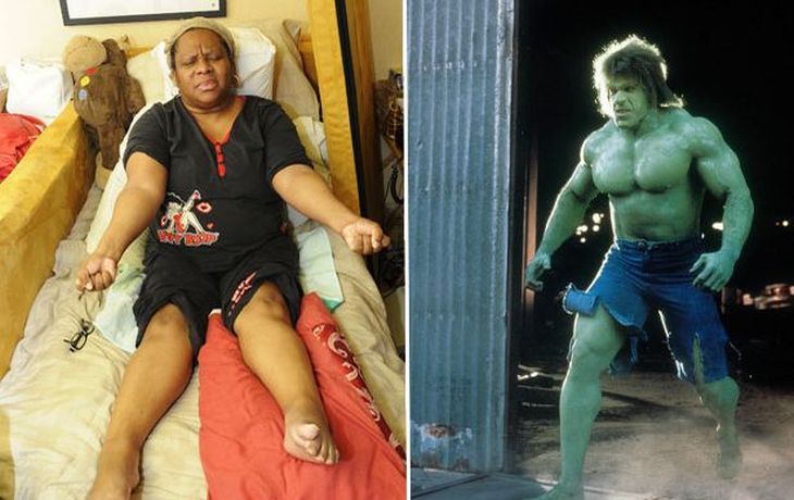 Una mujer se convierte en la Increíble Hulk femenina