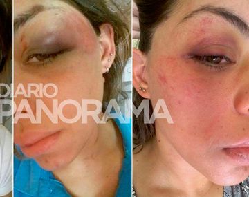Florencia González de 28 años fue salvajemente golpeada por su ex pareja.