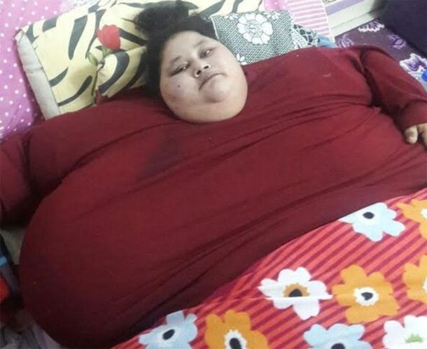 Tiene 36 años y es la mujer más obesa del mundo: Necesita una operación urgente