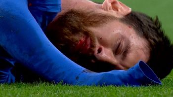 El rosarino quedó tendido en el césped del Santiago Bernabeu El rosarino quedó tendido en el césped del Santiago Bernabeu