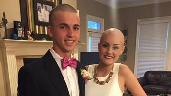 su pareja tiene cancer, asi que se rapo para ir juntos a una fiesta en el colegio su pareja tiene cancer, asi que se rapo para ir juntos a una fiesta en el colegio