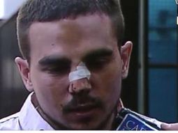 un joven denuncia brutal golpiza de patovicas en un boliche de palermo un joven denuncia brutal golpiza de patovicas en un boliche de palermo