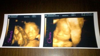 la primera imagen de las gemelas de cinthia fernandez la primera imagen de las gemelas de cinthia fernandez