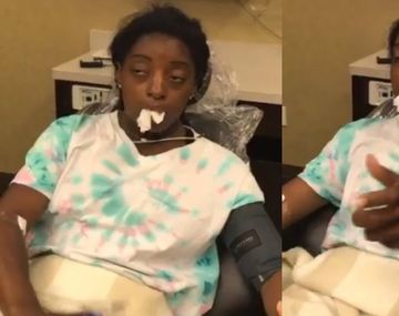 Simone Biles mostró su costado histriónico bajo el efecto de la anestesia