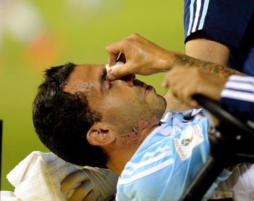 Martino sufrió otra baja: Tevez no jugará frente a Brasil