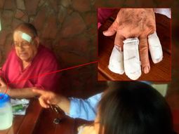 Así le dejaron la mano al juez que fue asaltado y torturado en Misiones