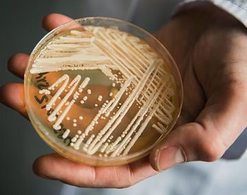 Confirman en Buenos Aires primeros casos argentinos del hongo Candida auris