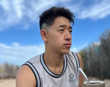 El antes y después: así luce Martín Ku tras su cirugía de nariz