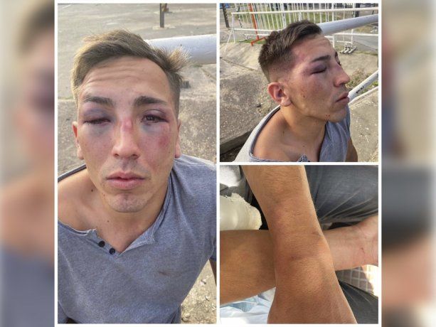 Brutal golpiza a un joven en un reconocido boliche de Costanera