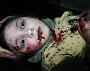 La foto del año 2013 según Unicef: la mirada perdida de una niña herida por una bomba