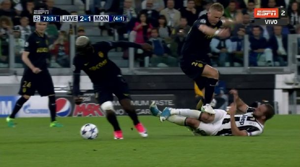 El tremendo pisotón que sufrió Gonzalo Higuaín ante Mónaco