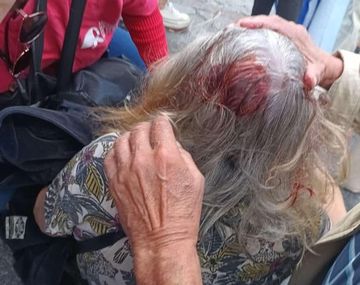 VIDEO: un policía le dio un palazo en la cabeza a una jubilada en el Congreso
