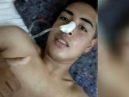 Gendarmería baleó por la espalda a un joven que intentó esquivar un control