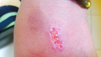 Este es el nuevo juego peligroso entre los adolescentes Este es el nuevo juego peligroso entre los adolescentes