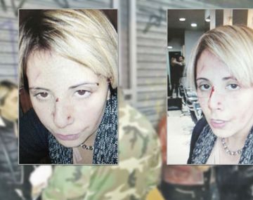 Dora Tula fue agredida por el dueño de la peluquería en la que trabajaba