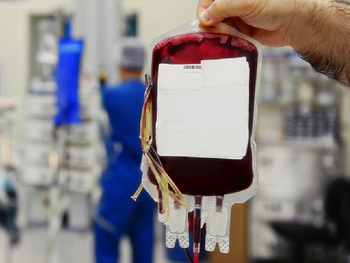 Aseguran que el tratamiento con plasma tiene eficacia limitada en pacientes con coronavirus