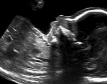 El tierno mensaje de un bebé desde la panza