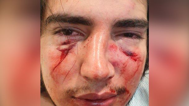 Feroz paliza de cuatro rugbiers a un joven de 18 años en Córdoba