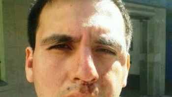 patovica le fracturo el maxilar a un futbolista en lanus patovica le fracturo el maxilar a un futbolista en lanus