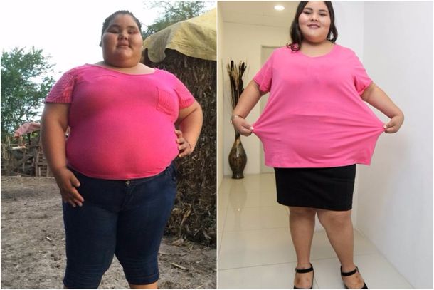 Tiene 14 años y bajó 90 kilos para celebrar sus 15