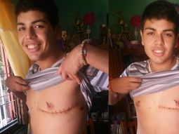 Joven de 16 años vive con una bala en su corazón
