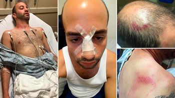 video: un hombre denuncio que un grupo de policias le dio una paliza por ser gay video: un hombre denuncio que un grupo de policias le dio una paliza por ser gay