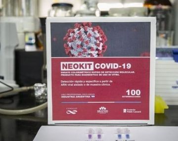 Intensifican la fabricación del test argentino para detectar el coronavirus
