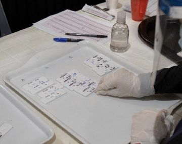 El Ministerio de Salud cambió la definición de caso sospechoso de coronavirus Covid-19