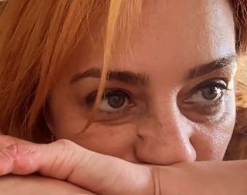 María Julia Oliván mostró las cicatrices que le dejó el grave accidente que sufrió