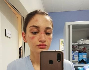 El mensaje y las fotos de dos enfermeras agotadas por el coronavirus