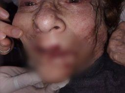 indignacion en mar del plata: un enfermero fue filmado mientras golpeaba a una anciana en un geriatrico indignacion en mar del plata: un enfermero fue filmado mientras golpeaba a una anciana en un geriatrico