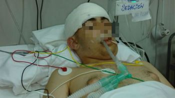 un cadete del liceo militar dejo a otro en terapia intensiva despues de una pelea un cadete del liceo militar dejo a otro en terapia intensiva despues de una pelea