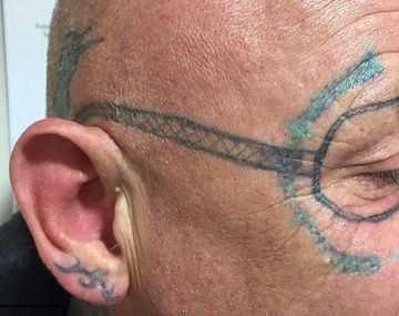 ¿La peor resaca? Se fue de fiesta y despertó con un horrendo tatuaje en la cara