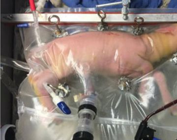 Lograron que el feto se desarrollara en un útero artificial