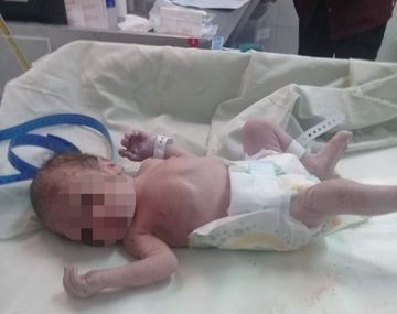 Rescataron a un bebé recién nacido que habían abandonado en la puerta de una casa en La Tablada