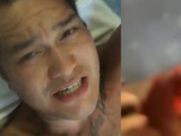 lo ataco un tiburon y compartio las imagenes de la herida en instagram lo ataco un tiburon y compartio las imagenes de la herida en instagram