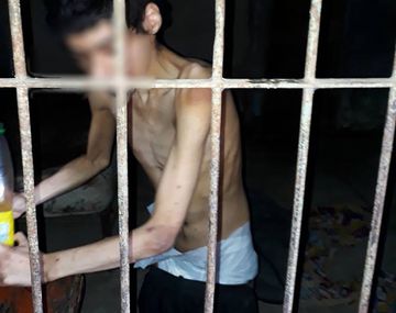 Imagen desgarradora: un joven discapacitado vive encerrado y sin comida