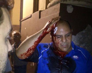 La Policía volvió a la calle y reprimió a manifestantes