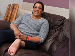 le reconstruyen la rodilla con su pie amputado le reconstruyen la rodilla con su pie amputado