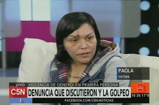 El desgarrador relato de una mujer, ferozmente atacada por su novio