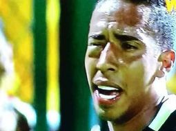 El delantero terminó desfigurado