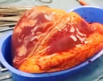 Difunden un video de cómo late el corazón de un adicto fuera de su cuerpo