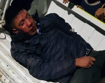 Se cansaron de la inseguridad y le amputaron dos dedos a un presunto ladrón