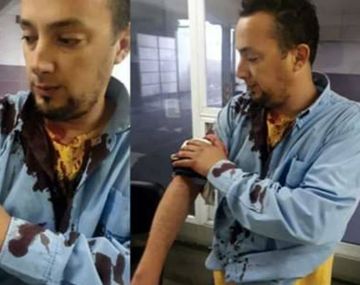 Otro ataque a un colectivero: lo apuñalaron con una trincheta en Moreno