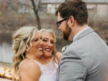 Una de las famosas siamesas Hensel encontró el amor y se casó